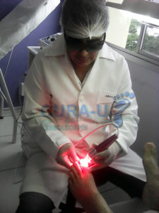 terapia-fotodinamica22