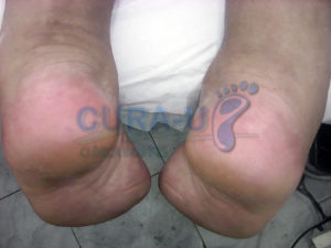 Depois