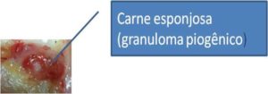 caso4.2