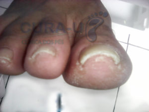 Figura 1