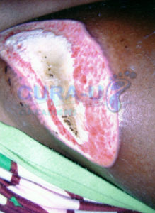 trabalho-de-papaina-3